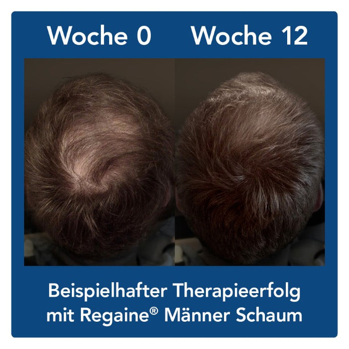 Regaine Männer Lösung, 60 ml Solution