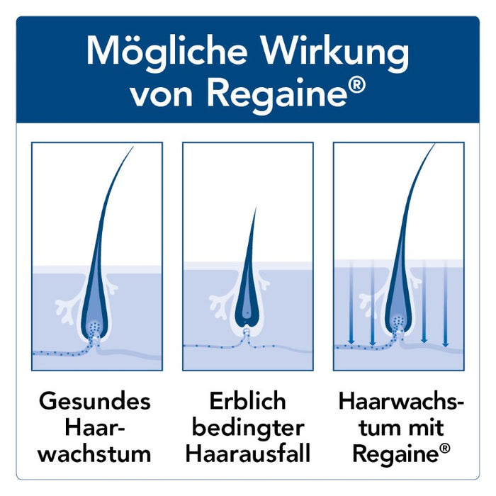 Regaine Männer Lösung, 60 ml Solution